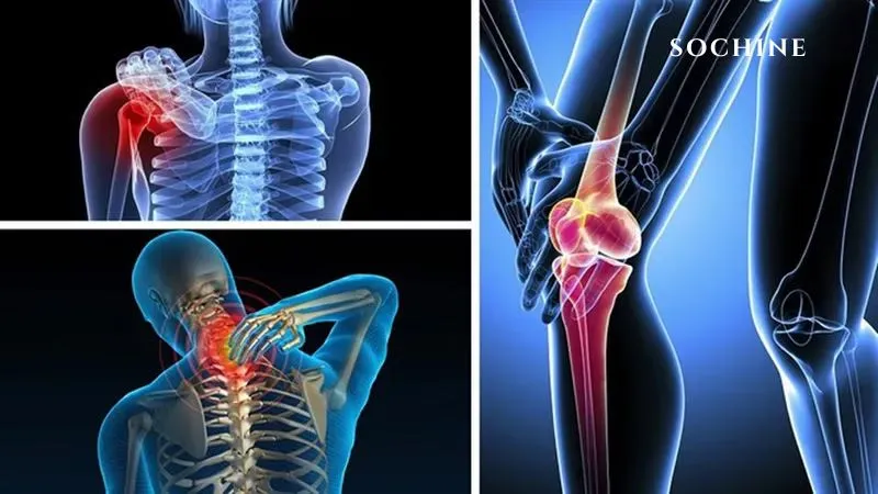 Cajeput (Tinh Dầu Tràm Gió) Là Gì? Công Dụng Và Cách Dùng Hiệu Quả 3 Tràm gió Giảm đau xương khớp hiệu quả